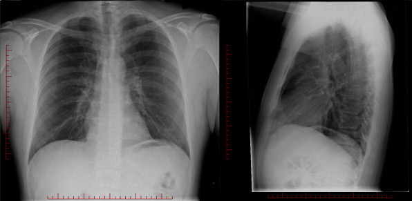 radiographie numérique sur des écrans d'ordinateur