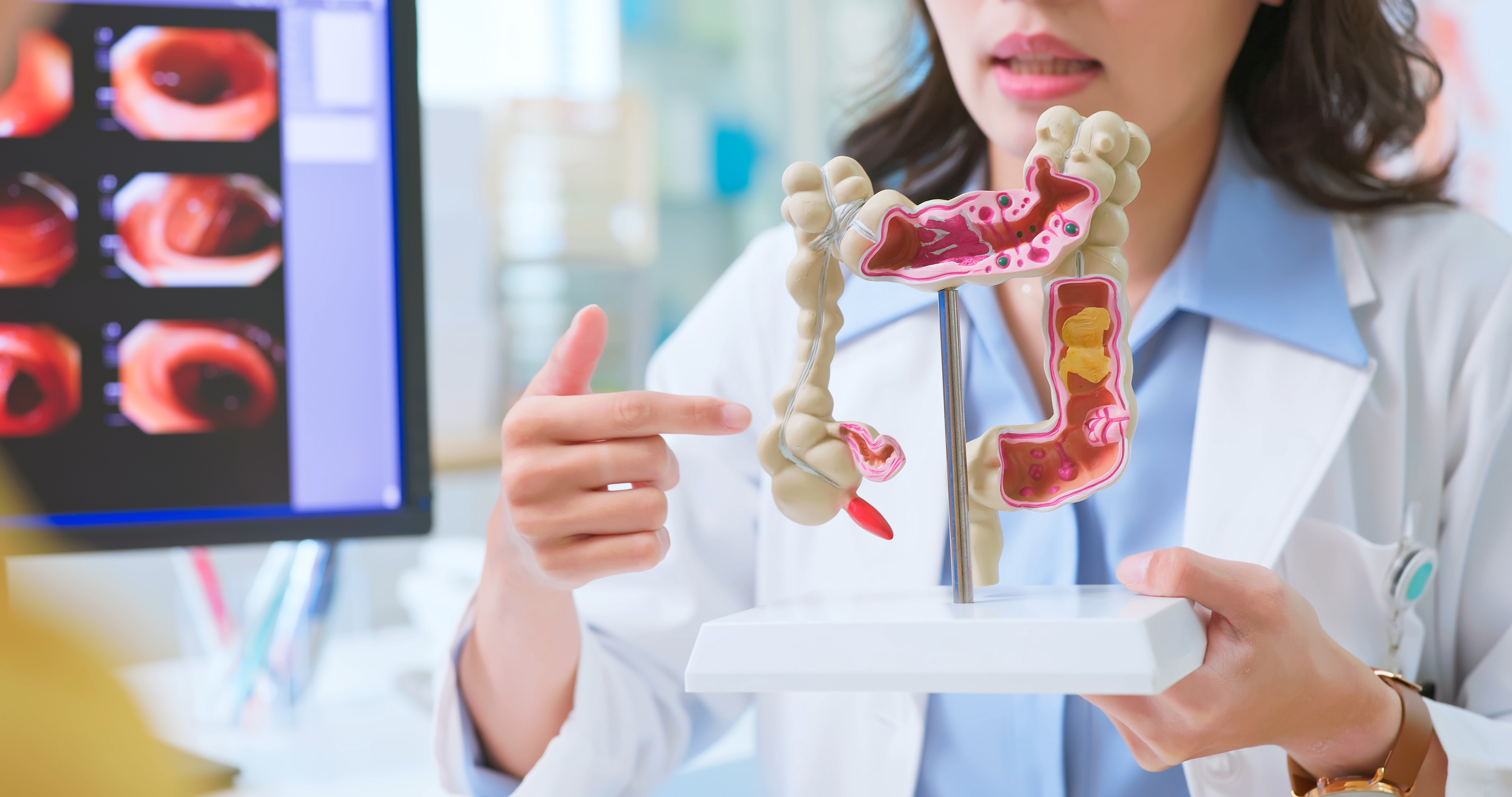 colorectal