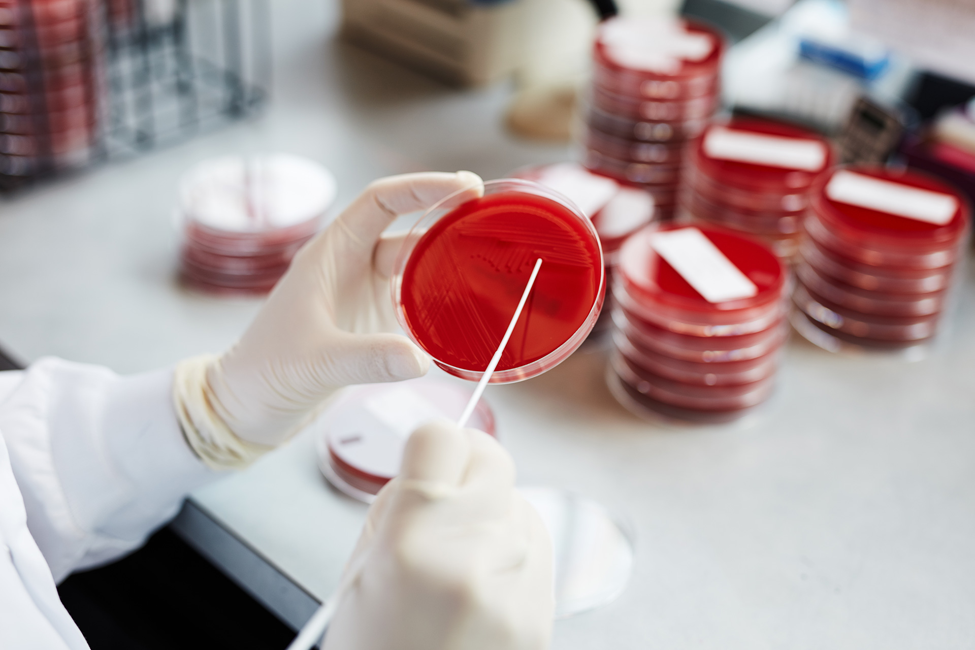 Biron scientific image of bacterial culture