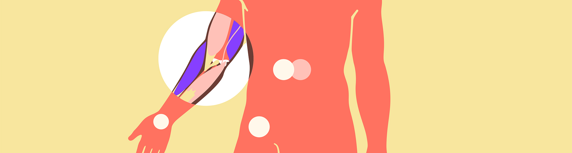 Elbow pain